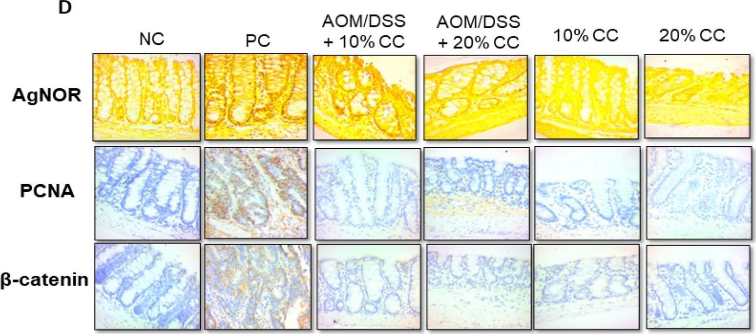Fig.2.D showing Immunohistochemistry-paraffin in a Mus musculus (House mouse) sample from the publication: Chemopreventive Effect of Cooked Chickpea on Colon Carcinogenesis Evolution in AOM/DSS-Induced Balb/c Mice.