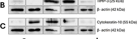 Fig.3.B showing Western Blotting from the publication: Immunohistochemical and western blot expression of MMPs, TIMPs, and cytokeratin 10 in feline squamous cell carcinoma.