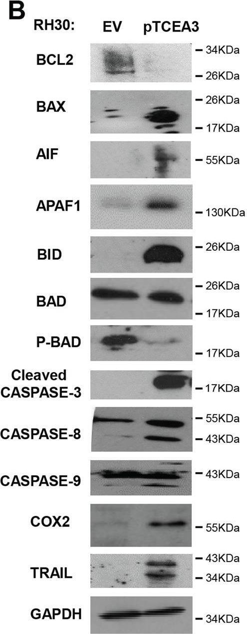 Fig.6.B showing Western Blotting from the publication: The transcription elongation factor TCEA3 induces apoptosis in rhabdomyosarcoma.