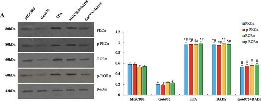 Fig.4.A showing Western Blotting from the publication: DADS Regulates EMT and Chemotherapy Resistance by Inhibiting RORα/β-Catenin Signaling through PKCα-Dependent Phosphorylation in Gastric Cancer.