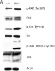 Fig.5.A showing Western Blotting from the publication: Apc mutation enhances PyMT-induced mammary tumorigenesis.