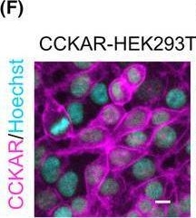 Fig.1.F showing Immunocytochemistry-immunofluorescence in a Homo sapiens (Human) sample from the publication: Functional engineering of human iPSC-derived parasympathetic neurons enhances responsiveness to gastrointestinal hormones.