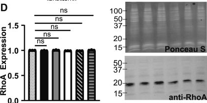 Fig.3.D showing Western Blotting from the publication: Genetic variants linked to neurodevelopmental disorders within the β3-β4 loop of the TRIO PH2 domain release autoinhibition of GEF2 activity.