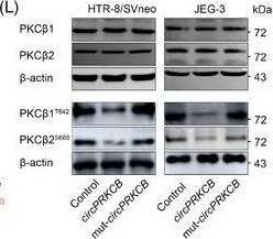 Fig.5.L showing Western Blotting from the publication: A hidden proteome encoded by circRNAs in human placentas: Implications for uncovering preeclampsia pathogenesis.