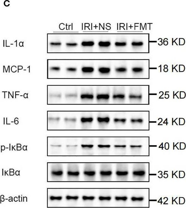 Fig.2.C showing Western Blotting from the publication: Propionic acid mediates the renoprotective effects of fecal microbiota transplantation against ischemia-reperfusion injury via upregulating GPR43.