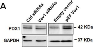 Fig.5.A showing Western Blotting in a Homo sapiens (Human) sample from the publication: Vav1 Sustains the Expression of Insulin, PDX1 and miR-375 During Differentiation of hiPSCs to β Cells: A Potential Target to Improve the In Vitro Generation of Insulin-Producing Cells.