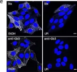Fig.6.E showing Immunocytochemistry-immunofluorescence in a Homo sapiens (Human) sample from the publication: Addition of lysophospholipids with large head groups to cells inhibits Shiga toxin binding.