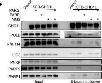 Fig.5.F showing Western Blotting in a Homo sapiens (Human) sample from the publication: CHD1L maintains genome integrity by facilitating okazaki fragment maturation.