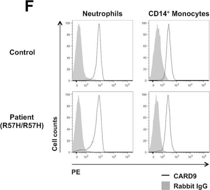 Fig.1.F showing Flow cytometry/Cell sorting in a Homo sapiens (Human) sample from the publication: CARD9-Dependent Neutrophil Recruitment Protects against Fungal Invasion of the Central Nervous System.