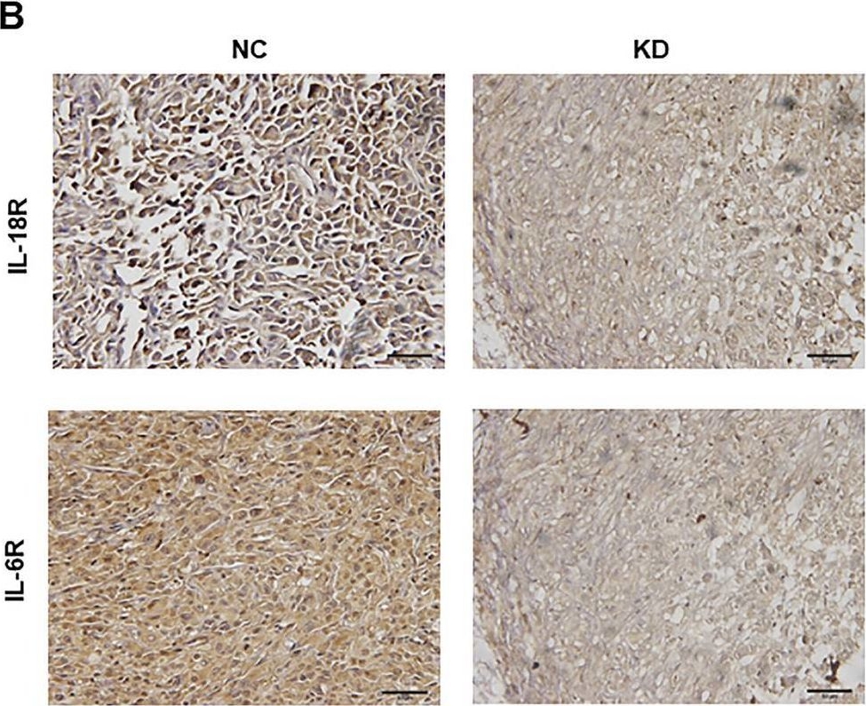 Fig.7.B showing Immunohistochemistry from the publication: Glioblastoma cellular MAP4K1 facilitates tumor growth and disrupts T effector cell infiltration.