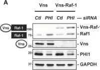 Fig.4.A showing Western Blotting in a Homo sapiens (Human) sample from the publication: PHI-1, an Endogenous Inhibitor Protein for Protein Phosphatase-1 and a Pan-Cancer Marker, Regulates Raf-1 Proteostasis.