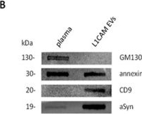 Fig.1.B showing Western Blotting in a Homo sapiens (Human) sample from the publication: Proteomic Exploration of L1CAM+-Extracellular Vesicles from Plasma of Manifest and Prodromal Parkinson's Disease.