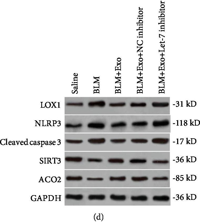 Fig.6.D showing Western Blotting in a Mus musculus (House mouse) sample from the publication: Exosomal miRNA Let-7 from Menstrual Blood-Derived Endometrial Stem Cells Alleviates Pulmonary Fibrosis through Regulating Mitochondrial DNA Damage.