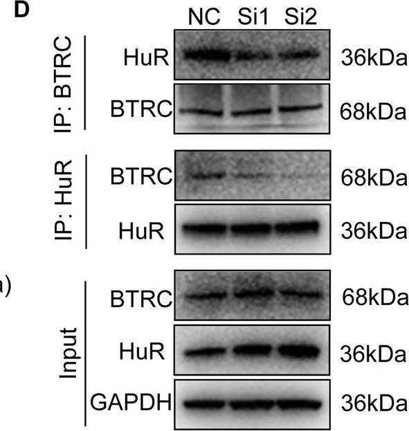 Fig.7.D showing Western Blotting in a Homo sapiens (Human) sample from the publication: Long noncoding RNA ASB16-AS1 inhibits adrenocortical carcinoma cell growth by promoting ubiquitination of RNA-binding protein HuR.