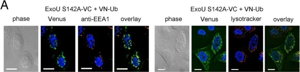 Fig.5.A showing Immunocytochemistry-immunofluorescence from the publication: Structural basis of cytotoxicity mediated by the type III secretion toxin ExoU from Pseudomonas aeruginosa.