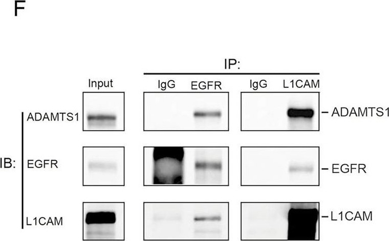 Fig.4.F showing Western Blotting in a Homo sapiens (Human) sample from the publication: Cyclic increase in the ADAMTS1-L1CAM-EGFR axis promotes the EMT and cervical lymph node metastasis of oral squamous cell carcinoma.