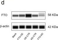 Fig.3.D showing Western Blotting in a Homo sapiens (Human) sample from the publication: Insulin signaling pathway related m6A methylated biomarker for type 2 diabetes and the potential modulation mechanism.
