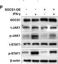Fig.5.P showing Western Blotting in a Mus musculus (House mouse) sample from the publication: CAR-T triggers TAM reeducation and adaptive anti-tumor response via TREM2 deficiency or CD40 agonist.