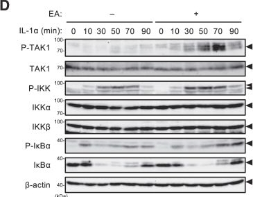 Fig.4.D showing Western Blotting in a Homo sapiens (Human) sample from the publication: Elaidic acid drives cellular senescence and inflammation via lipid raft-mediated IL-1R signaling.