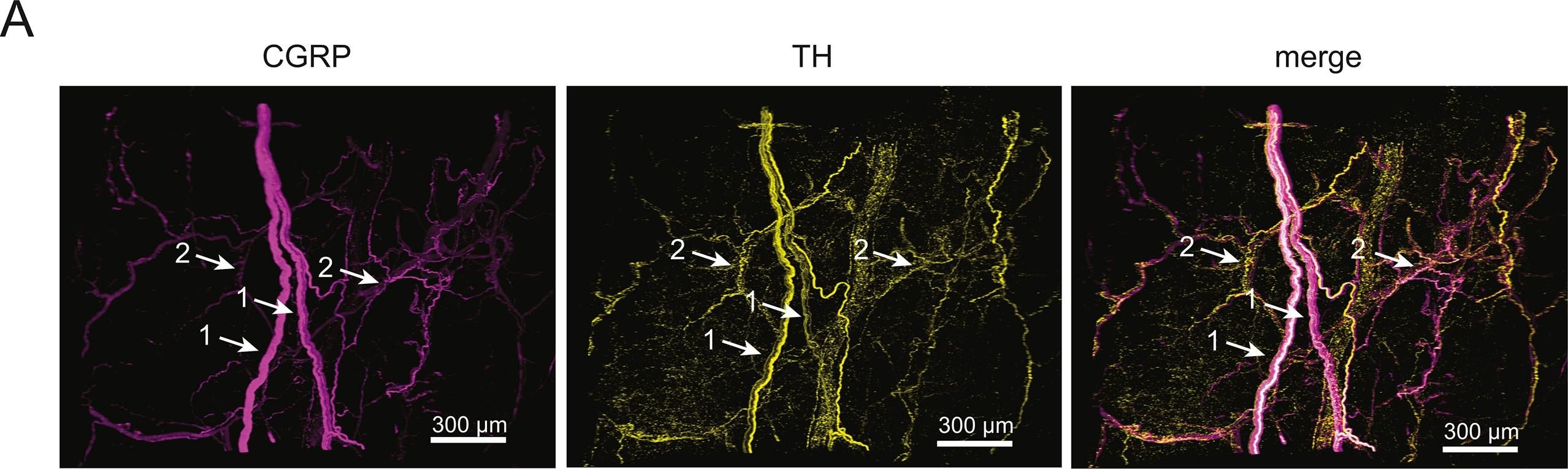 Fig.4.A showing Immunohistochemistry-immunofluorescence in a Mus musculus (House mouse) sample from the publication: Adipose mTORC2 is essential for sensory innervation in white adipose tissue and whole-body energy homeostasis.