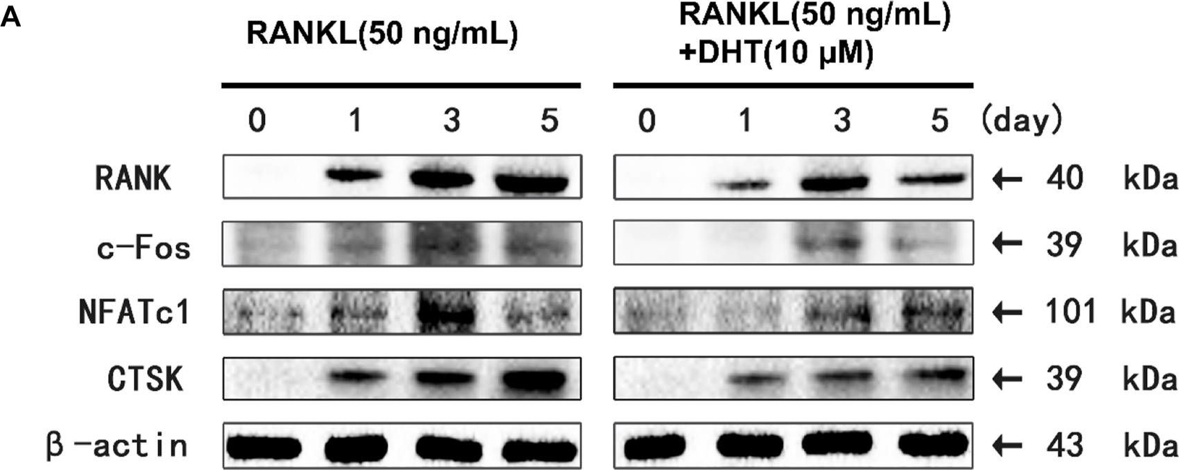 Fig.7.A showing Western Blotting in a Mus musculus (House mouse) sample from the publication: Dehydromiltirone inhibits osteoclast differentiation in RAW264.7 and bone marrow macrophages by modulating MAPK and NF-κB activity.
