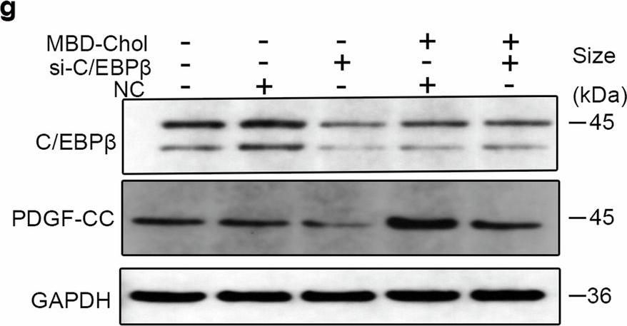 Fig.6.G showing Western Blotting in a Mus musculus (House mouse) sample from the publication: C/EBPβ activation in vascular smooth muscle cells promotes hyperlipidemia-induced phenotypic transition and arterial stiffness.