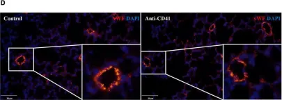 Fig.3.D showing Immunohistochemistry-immunofluorescence from the publication: Platelets are indispensable for alveolar development in neonatal mice.