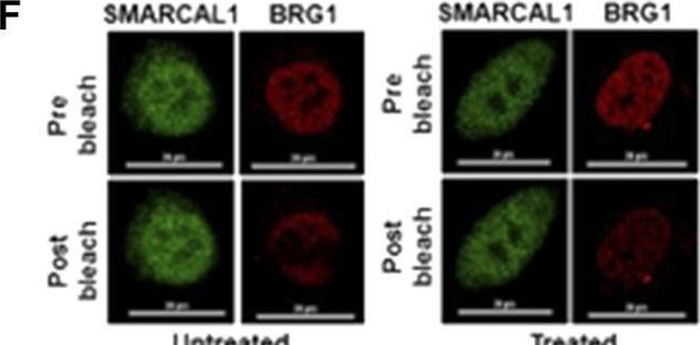 Fig.2.F showing Immunocytochemistry-immunofluorescence in a Homo sapiens (Human) sample from the publication: On the Interaction Between SMARCAL1 and BRG1.
