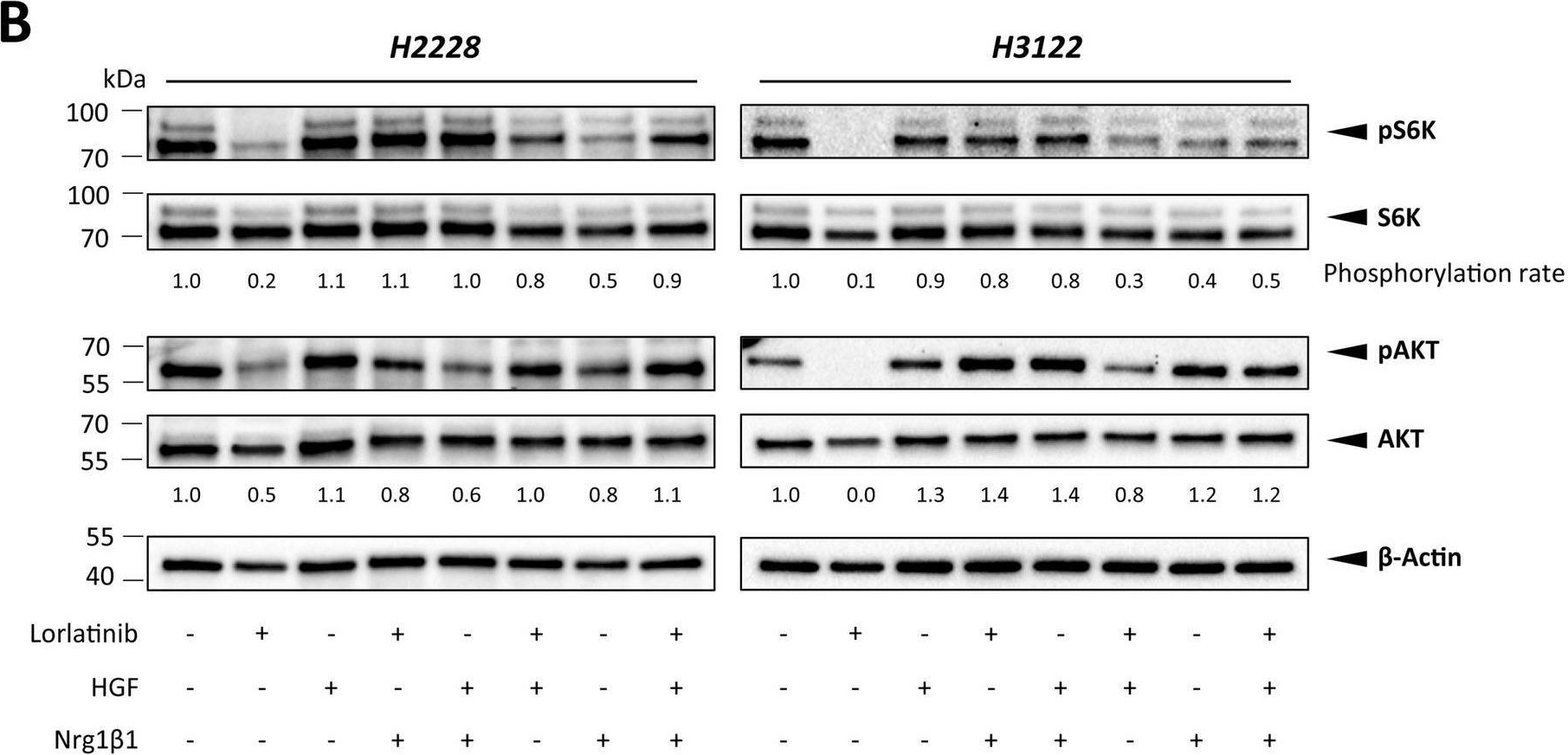 Fig.7.B showing Western Blotting in a Homo sapiens (Human) sample from the publication: Cancer-associated fibroblasts promote drug resistance in ALK-driven lung adenocarcinoma cells by upregulating lipid biosynthesis.