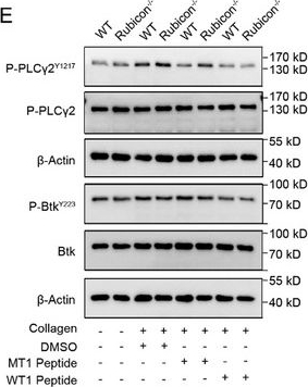 Fig.7.E showing Western Blotting in a Mus musculus (House mouse) sample from the publication: Platelet Rubicon Bidirectional Regulation of GPVI and Integrin αIIbβ3 Signaling Mitigates Stroke Infarction Without Compromising Hemostasis.