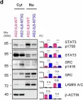 Fig.4.D showing Western Blotting from the publication: Defective N-glycosylation of IL6 induces metastasis and tyrosine kinase inhibitor resistance in lung cancer.