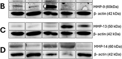 Fig.2.B showing Western Blotting in a Felis catus (Domesticated cat) sample from the publication: Immunohistochemical and western blot expression of MMPs, TIMPs, and cytokeratin 10 in feline squamous cell carcinoma.