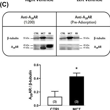 Fig.4.C showing Western Blotting in a Mus musculus (House mouse) sample from the publication: Blockage of the adenosine A2B receptor prevents cardiac fibroblasts overgrowth in rats with pulmonary arterial hypertension.