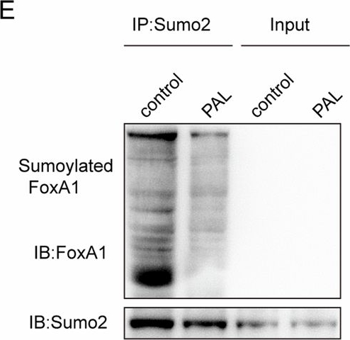 Fig.4.E showing Western Blotting from the publication: Impaired SUMOylation of FoxA1 promotes nonalcoholic fatty liver disease through down-regulation of Sirt6.