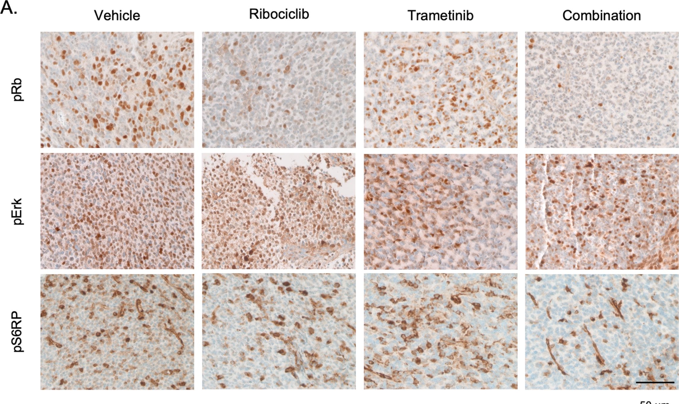 Fig.6.A showing Immunohistochemistry in a Mus musculus (House mouse) sample from the publication: Effects of combination therapy of a CDK4/6 and MEK inhibitor in diffuse midline glioma preclinical models.