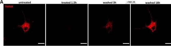 Fig.6.A from the publication: Single Cell Analysis of Reversibility of the Cell Death Program in Ethanol-Treated Neuronal PC12 Cells.
