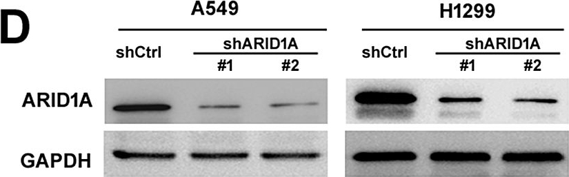 Fig.1.D showing Western Blotting in a Homo sapiens (Human) sample from the publication: PLAU promotes growth and attenuates cisplatin chemosensitivity in ARID1A-depleted non-small cell lung cancer through interaction with TM4SF1.