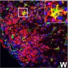 Fig.7.W showing Immunocytochemistry-immunofluorescence in a Mus musculus (House mouse) sample from the publication: IFN-gamma signaling in the central nervous system controls the course of experimental autoimmune encephalomyelitis independently of the localization and composition of inflammatory foci.