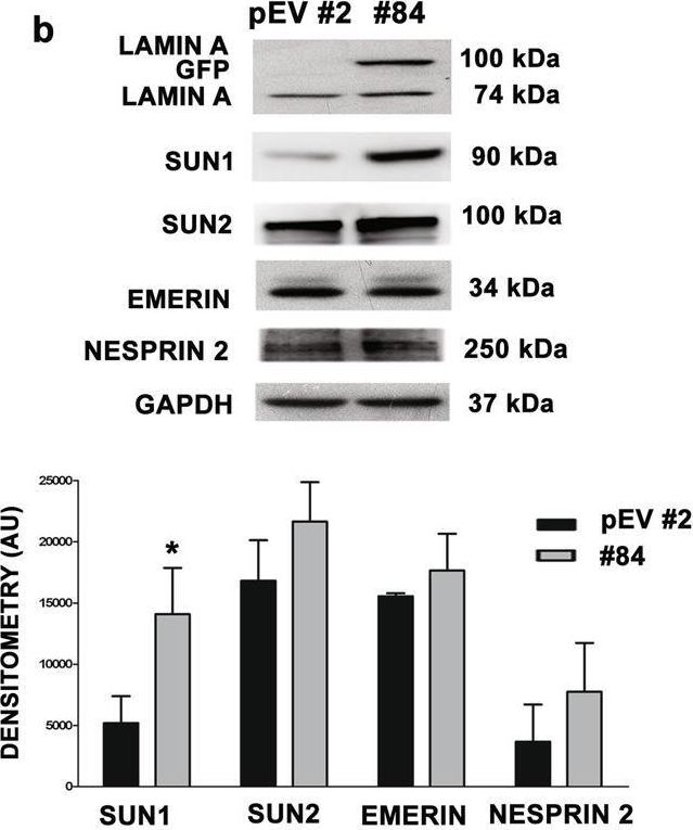 Fig.4.B showing Western Blotting from the publication: Lamin A and the LINC complex act as potential tumor suppressors in Ewing Sarcoma.