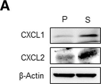Fig.6.A showing Western Blotting in a Mus musculus (House mouse) sample from the publication: Tumor stem-like cell-derived exosomal RNAs prime neutrophils for facilitating tumorigenesis of colon cancer.