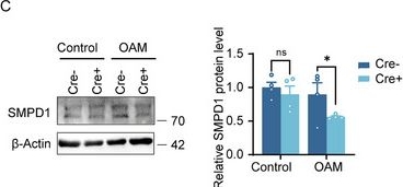 Fig.7.C showing Western Blotting in a Mus musculus (House mouse) sample from the publication: AXL Promotes Ischemic Myelin Repair Through Alleviating Myelin Debris Deposition and Lipid Droplets Accumulation.