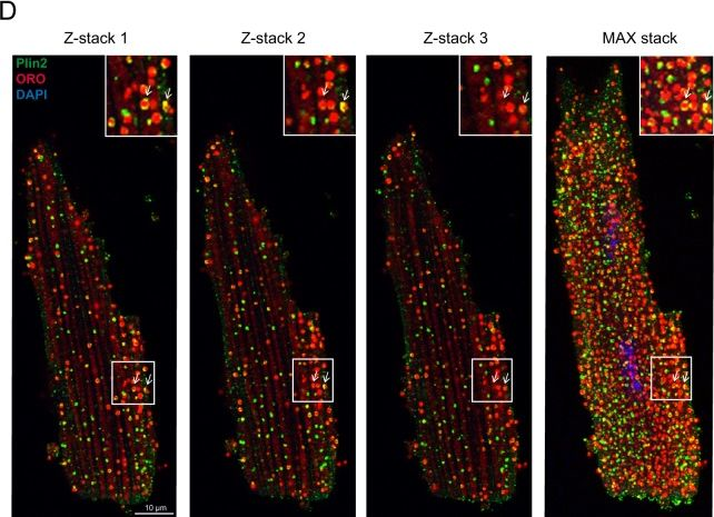 Fig.1.D showing Western Blotting in a Mus musculus (House mouse) sample from the publication: Plin2-deficiency reduces lipophagy and results in increased lipid accumulation in the heart.