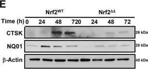Fig.2.E showing Western Blotting in a Mus musculus (House mouse) sample from the publication: Nrf2 dynamically regulates RANKL-induced osteoclastogenesis and cathepsin K function.