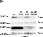 Fig.2.B showing Western Blotting from the publication: Antitumor Effects of Ral-GTPases Downregulation in Glioblastoma.