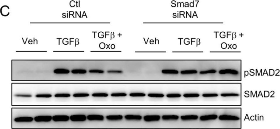 Fig.6.C showing Western Blotting from the publication: Oxoglaucine Suppresses Hepatic Fibrosis by Inhibiting TGFβ-Induced Smad2 Phosphorylation and ROS Generation.
