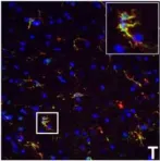 Fig.7.T showing Immunocytochemistry-immunofluorescence in a Mus musculus (House mouse) sample from the publication: IFN-gamma signaling in the central nervous system controls the course of experimental autoimmune encephalomyelitis independently of the localization and composition of inflammatory foci.