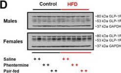Fig.4.D showing Western Blotting in a Rattus norvegicus (Rat) sample from the publication: Diet-induced obesity impairs refeeding responses and downregulates lateral septal GLP-1R in male rats: an effect reversed by weight-loss treatment.