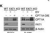 Fig.2.K showing Western Blotting from the publication: Inhibiting FAT1 Blocks Metabolic Bypass to Enhance Antitumor Efficacy of TCA Cycle Inhibition through Suppressing CPT1A-Dependent Fatty Acid Oxidation.