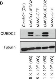 Fig.8.B showing Western Blotting in a Mus musculus (House mouse) sample from the publication: CUEDC2 modulates cardiomyocyte oxidative capacity by regulating GPX1 stability.