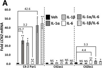 Fig.1.A from the publication: Chronic IL-1 Exposure Attenuates RELA- and STAT3-Dependent Synergistic Cytokine Signaling in Prostate Cancer Cell Lines.